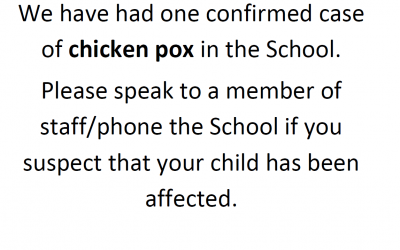 One confirmed case of chicken pox in school